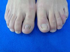 -世龙世家甲沟炎·灰指甲·嵌甲矫正·修脚(武侯区双楠店)