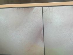 -苑苑vbeauty科技美容SPA