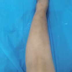 点击看大图 体验后-杭州奥拉克医疗美容门诊部