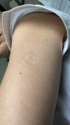 -明星刺青·洗纹身