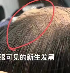 点击看大图 -侗秀养发•头疗