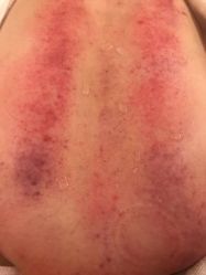 -苑苑vbeauty科技美容SPA