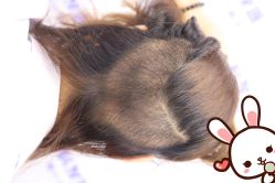 点击看大图 -大麦微针植发丨全国连锁