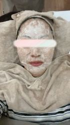 -苗方清颜•痘肌问题肌专研