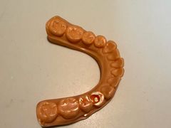 -上海仁爱医院口腔科 · 种植