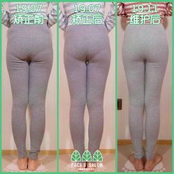 -FACE·日本小颜矫正美容整骨サロン