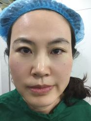 -天津健丽·去眼袋医疗美容机构