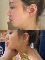 -郡艺医疗美容·微整·眼鼻吸脂