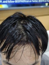 -雍禾植发