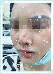 -SKINIST丽铂医疗美容