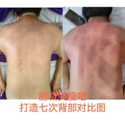 -丽减美瘦吧·减肥瘦身