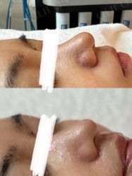 点击看大图 -AURAS璈然科技护肤中心