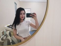 体验后-郡艺医疗美容·微整·眼鼻吸脂
