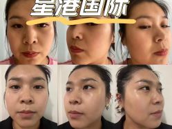 -星港国际·Skin皮肤专研·皮肤管理