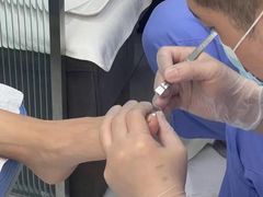 -Andrew指甲专科灰指甲·甲沟炎矫正·3D步态矫形鞋垫定制(浦三路店)