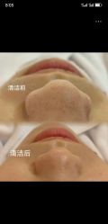 -LUNA皮相美·骨相美高级美感