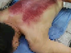 -张钰强中医正骨推拿连锁(唐家人才公寓店)