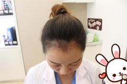 点击看大图 -大麦微针植发丨全国连锁