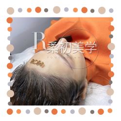-RC半永久纹眉纹发际线