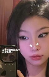 -北京米扬丽格医疗美容·联合丽格鼻整形中心