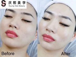 -S庆熙美学皮肤管理