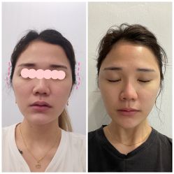 -郑荃丽格医疗美容