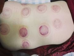 -广州仁爱天河医院体检中心