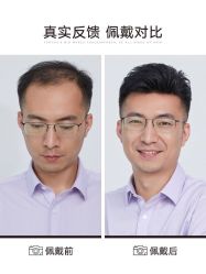 -发饰美男士增发补发假发定制店