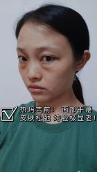 -深圳春天阳光医院·轮廓抗衰中心