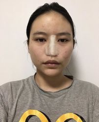 -广东韩妃整形外科医院