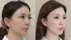 -上海伊莱美医疗美容医院