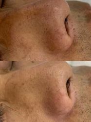 -蕾特恩专业祛痘·皮肤管理