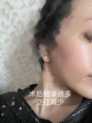 体验后-亚心总医院·皮肤管理