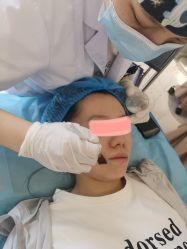体验前-武汉颜范薇美医疗美容门诊部