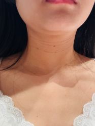 体验后-上海玫瑰医疗美容医院