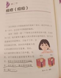 -苗方清颜痘肌研究所