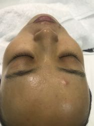 做之前-薇漫里纹眉半永久连锁品牌