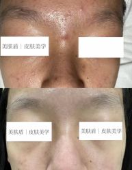 -美肤盾祛痘·问题肌头疗管理中心