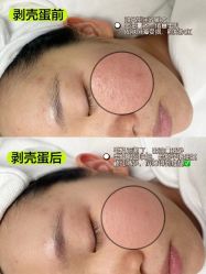 -凡碧诗毛孔清洁收细