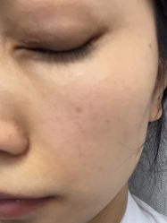 -长沙雅美医疗美容医院