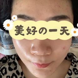 体验后-Metime美天医疗美容