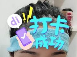 -大麦微针植发全国连锁