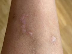 -中国医学科学院皮肤病医院