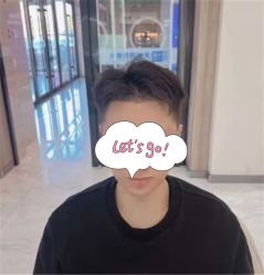 -大麦微针植发丨全国连锁