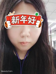 体验后-华臣医疗美容