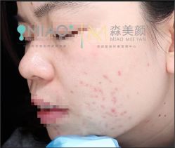 -韩国淼美颜皮肤管理官方直营店