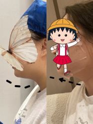 -针美汇欧邦医疗美容