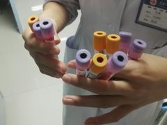 抽血化验-苏州大学附属第二医院(三香院区)