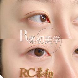 -RC半永久纹眉纹发际线