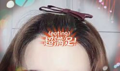 -大麦微针植发全国连锁